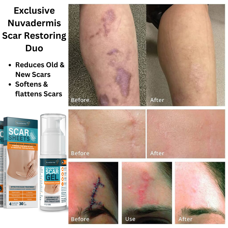 Exclusive Nuvadermis Scar Restoring Duo